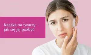 Zmartwiona dziewczyna dotyka policzka, na którym widać kaszkę. Tekst informuje, jak się jej pozbyć.