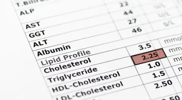 Wynik lipidogramu: trójglicerydy za niskie (1.0). Widoczne inne parametry jak cholesterol, HDL, LDL.