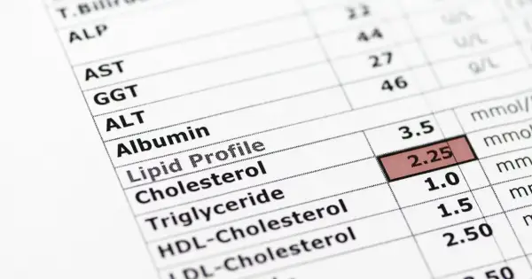Wynik lipidogramu: trójglicerydy za niskie (1.0). Widoczne inne parametry jak cholesterol, HDL, LDL.