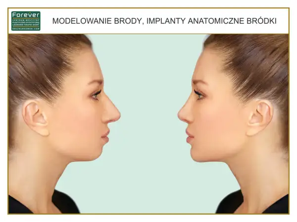 Modelowanie brody: porównanie profilu twarzy przed i po zabiegu. Widoczne zmiany w linii żuchwy i podbródka.